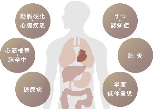 動脈硬化・心臓疾患・心筋梗塞・脳卒中・糖尿病・うつ・認知症・肺炎・早産・低体重児