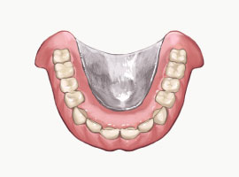 コバルトクロム床義歯